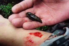 螞蟥咬人怎么辦？螞蟥怎么能殺死？